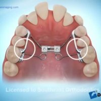 دستگاه ترکیبی پندولوم