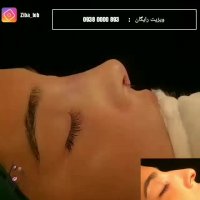 جراحی بینی در مشهد | مشاوره رایگان 09380000893