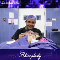 قبل و بعد از جراحی بینی | دکتر شهریار یحیوی