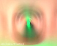 جراحی زیبایی بینی در ترکیه