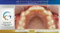 ارتودنسی شمال تهران | متخصص ارتودنسی | دکتر داوودیان