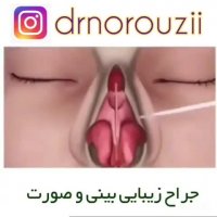 انیمیشن جراحی بینی
