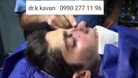 عمل بینی توسط دکتر کاوان
