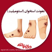 صحبت های دکتر جمال میرزایی در مورد عفونت استخوان