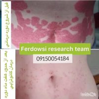 پیسی درمان دارد