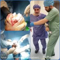 فیلم عمل جراحی تعویض مفصل زانوی سمت راست