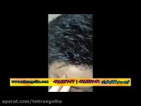 روش ترمیم مو