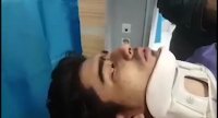 روایت یکی از دانشجویان مصدوم از سانحه‌ی رانندگی در نزدیکی دانشگاه آزاد واحد علوم و تحقیقات