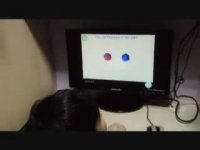 بیش فعالی و روش درمان آن (ADHD)