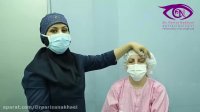 فیلم واقعی جراحی بلفاروپلاستی