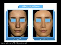 مروری بر نمونه كارهای ‎دكتر پیمان برومند در سالی گذشت