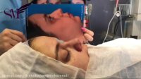 فیلم جراحی زیبایی بینی