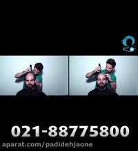 ترمیم مو و کاشت موی طبیعی بدون جراحی