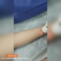 دستگاه لیزر رفع موهای زائد دوئتو ایتالیا (Duetto MT) در مطب دکتر هاشمیان