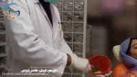 قالب گیری دندان | دکتر مسعود داوودیان