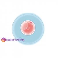 نحوه انجام آی وی اف یا لقاح آزمایشگاهی