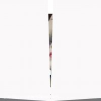 بلافاصله پس از ساکشن غبغب