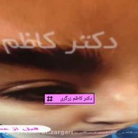 رضایت بیمار بعد از جراحی بینی