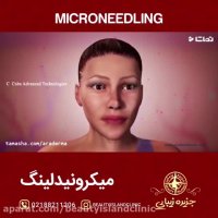 میکرونیدلینگ به روایت تصویر
