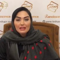 کاشت ابرو طبیعی در کلینیک رنسانس