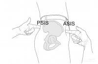 نحوه تشخیص گودی کمر