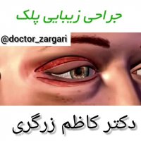 انیمیشن جراحی زیبایی پلک
