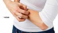 چرا ما احساس خارش داریم؟