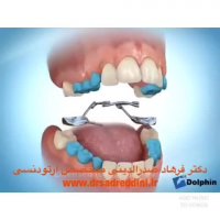 متخصص ارتودنسی در غرب تهران