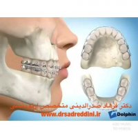 متخصص ارتودنسی در غرب تهران
