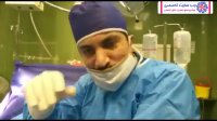 عمل واریکوسل چگونه انجام می شود؟