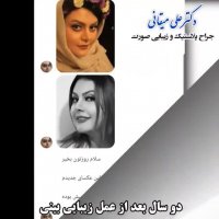 نتیجه عمل زیبایی بینی بعد از دو سال