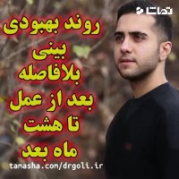روند بهبودی بینی بلافاصله بعد از عمل تا هشت ماه بعد | دکتر گلی