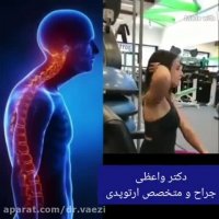 تمرین برای افرادی که قوز می کنند