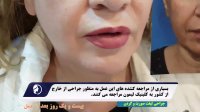 لیفت صورت و گردن تیم جراحی لیمون