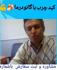کبد چرب و پبشگیری