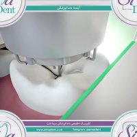 آینده دندانپزشکی | دندانپزشکی سیمادنت