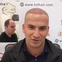 کاشت مو رنسانس - کلینیک تخصصی رنسانس