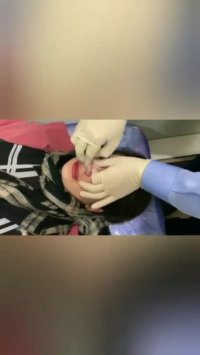 فیلم طریقه صحیح چسب زدن بینی