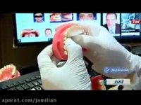 درمان ناهنجاری فک با اختراع دستگاه کوچک در دهان / متخصص ارتودنسی